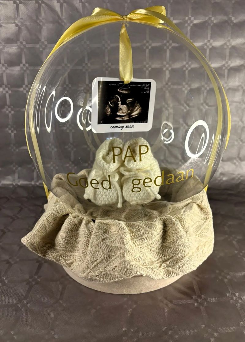 Body Balloon / Ultrasound + Baby Shoes – Unique Personalization 🎈👣